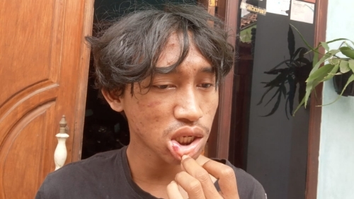 Seorang Pemuda di Malang Dihajar 5 Pemabuk Hingga Alami Trauma Kepala 16 Resizer 17198048598571