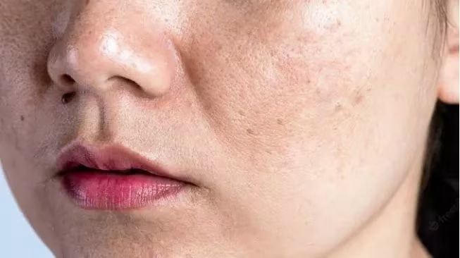 81098d1a 3b1b 4936 a689 dab22cbb3e5f