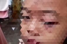 Potongan layar yang merekam bocah SD menjadi korban kekerasan dengan disiram kuah bakso panas oleh tantenya sendiri. (Istimewa)