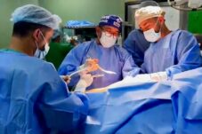 Dokter Kuntadi Sedang Melakukan Pembedahan Tulang pada Warga Palestina di Rumah Sakit An Nasr (Dok Humas UB)