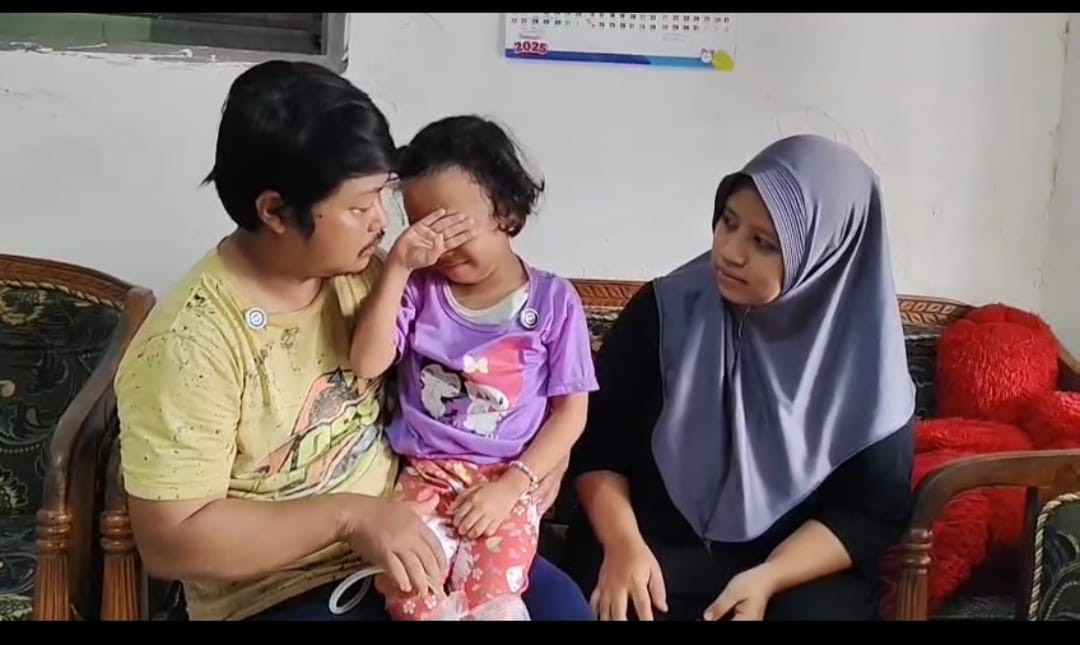 Dua Tahun Menanti Operasi, Ipda Purnomo Beri Bantuan Naila